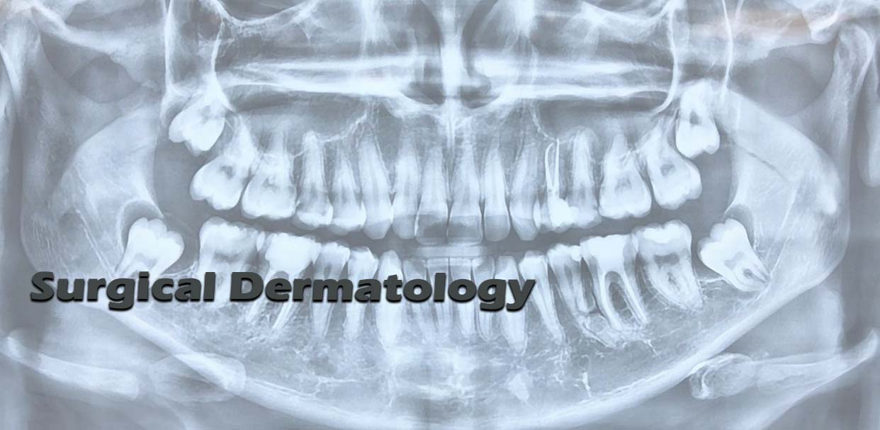 Surgical Dermatology